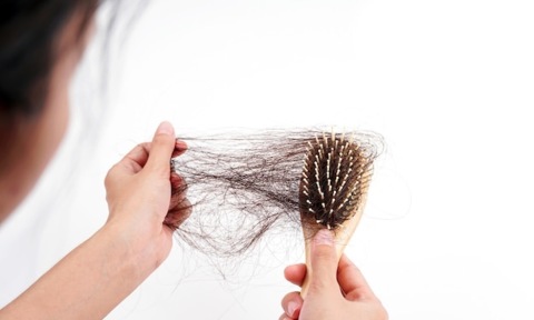 8 cách giảm rụng tóc do vảy nến da đầu